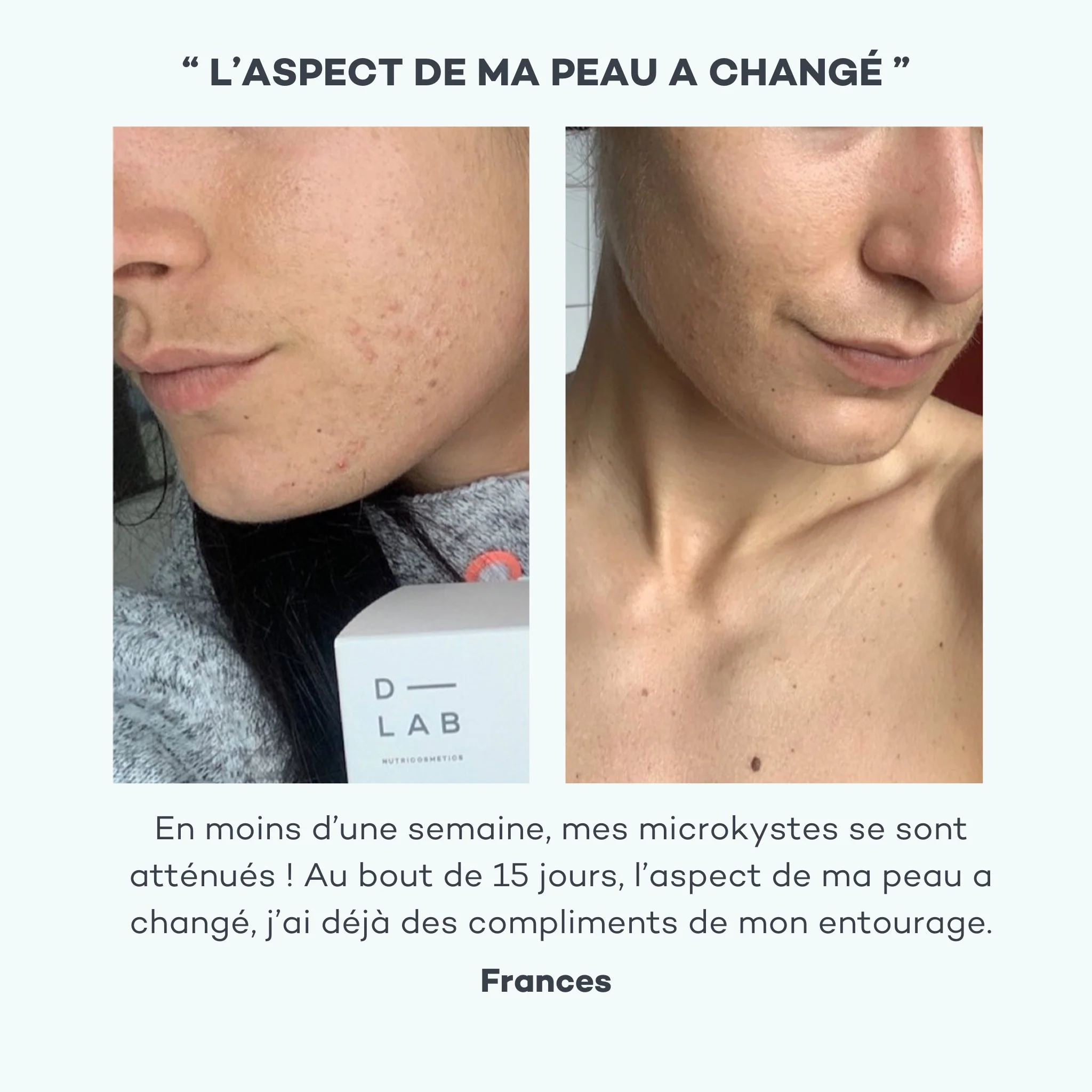 Programme Peau-Parfaite - Image 6